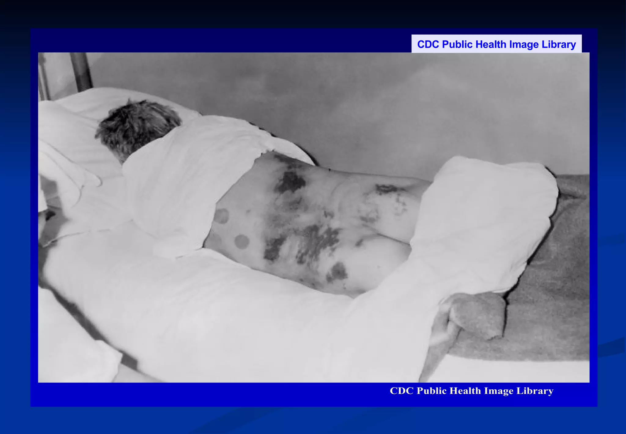 CDC Public Health Image Library 