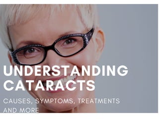 UNDERSTANDING
CATARACTS
CAUSES, SYMPTOMS, TREATMENTS
AND MORE
 