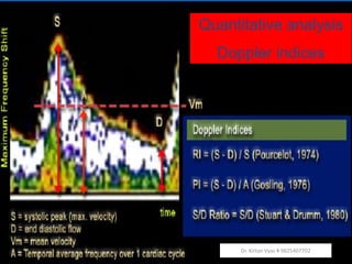 Quantitative analysis
Doppler indices
Dr. Kirtan Vyas # 9825407702
 