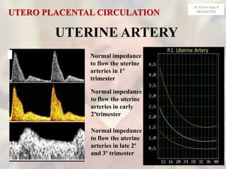 UTERINE ARTERY
Normal impedance
to flow the uterine
arteries in 1º
trimester
Normal impedance
to flow the uterine
arteries in early
2ºtrimester
Normal impedance
to flow the uterine
arteries in late 2º
and 3º trimester
UTERO PLACENTAL CIRCULATION
Dr. Kirtan Vyas #
9825407702
 