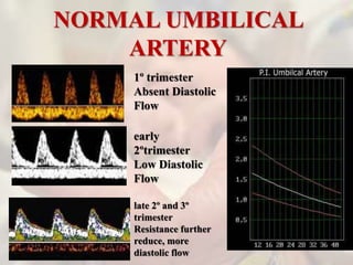 NORMAL UMBILICAL
ARTERY
1º trimester
Absent Diastolic
Flow
early
2ºtrimester
Low Diastolic
Flow
late 2º and 3º
trimester
Resistance further
reduce, more
diastolic flow
 