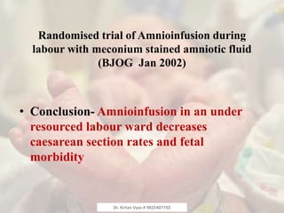 Randomised trial of Amnioinfusion during
labour with meconium stained amniotic fluid
(BJOG Jan 2002)
• Conclusion- Amnioinfusion in an under
resourced labour ward decreases
caesarean section rates and fetal
morbidity
Dr. Kirtan Vyas # 9825407702
 
