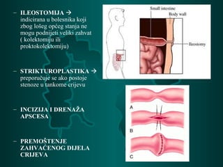 – ILEOSTOMIJA 
indicirana u bolesnika koji
zbog lošeg općeg stanja ne
mogu podnijeti veliki zahvat
( kolektomiju ili
proktokolektomiju)
– STRIKTUROPLASTIKA 
preporučuje se ako postoje
stenoze u tankome crijevu
– INCIZIJA I DRENAŽA
APSCESA
– PREMOŠTENJE
ZAHVAĆENOG DIJELA
CRIJEVA
 