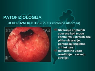 PATOFIZIOLOGIJAPATOFIZIOLOGIJA
ULCEROZNI KOLITIS (Colitis chronica ulcerosa)ULCEROZNI KOLITIS (Colitis chronica ulcerosa)
Stvaranje kriptalnihStvaranje kriptalnih
apscesa koji moguapscesa koji mogu
konfluirati i stvarati širekonfluirati i stvarati šire
plitke ulceracije,plitke ulceracije,
poremećaj kriptalneporemećaj kriptalne
arhitekturearhitekture
Rekurentne upaleRekurentne upale
rezultiraju u razvojurezultiraju u razvoju
atrofije;atrofije;
 