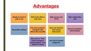 Advantages
Simple to insert &
safe to use
Visit to the clinic is
only once
High success rate
(97%)
High continuation
rate
Reversible method
Free from systemic,
metabolic side
effects like oral pills
Does not interfere
with sexual
intercourse
Does not interfere
with lactation
Also used as “Post-
coital emergency
contraceptives” (use
within 3-5 days)
Less risk of ectopic
pregnancy
 