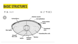 Cataract Structure Congenital Cataract | PPTX