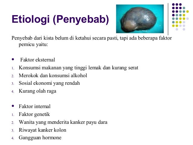 Penyebab Kista Sentra Agen S Lutena Tasikmalaya