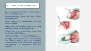 kista-epididimis-presentasi-penyakit-pptx