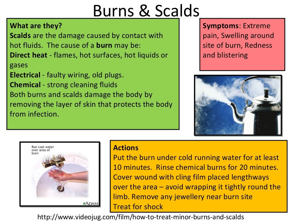 Kitchen first aid_in_the_kitchen