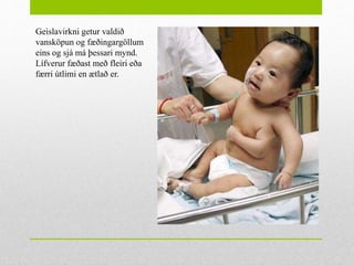 Geislavirkni getur valdið
vansköpun og fæðingargöllum
eins og sjá má þessari mynd.
Lífverur fæðast með fleiri eða
færri útlimi en ætlað er.
 