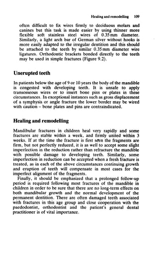 Killey and kay   fractures of mandible