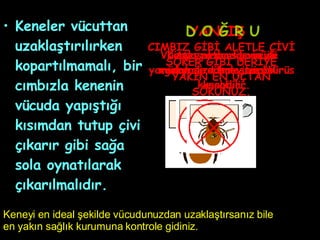 Keneler vücuttan uzaklaştırılırken kopartılmamalı, bir cımbızla kenenin vücuda yapıştığı kısımdan tutup çivi çıkarır gibi sağa sola oynatılarak çıkarılmalıdır.  YANLIŞ Vücudu patlarsa virüsü yaradan size bulaştırabilir. Ateş veya sigara ile müdahale etmeyiniz. Virüs kusabilir. Kimyasal madde veya gazyağı dökme, virüsü kusabilir. D O Ğ R U CIMBIZ GİBİ ALETLE ÇİVİ SÖKER GİBİ DERİYE YAKIN EN UÇTAN SÖKÜNÜZ. Keneyi en ideal şekilde vücudunuzdan uzaklaştırsanız bile en yakın sağlık kurumuna kontrole gidiniz. 