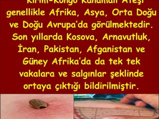 Kırım-Kongo Kanamalı Ateşi genellikle Afrika, Asya, Orta Doğu ve Doğu Avrupa’da görülmektedir. Son yıllarda Kosova, Arnavutluk, İran, Pakistan, Afganistan ve Güney Afrika’da da tek tek vakalara ve salgınlar şeklinde ortaya çıktığı bildirilmiştir. 