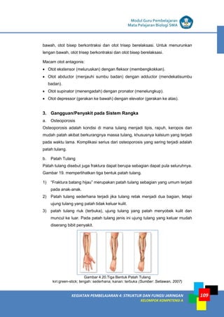 LISTRIK untuk SMP
KEGIATAN PEMBELAJARAN 4: STRUKTUR DAN FUNGSI JARINGAN
KELOMPOK KOMPETENSI A
Modul Guru Pembelajaran
Mata Pelajaran Biologi SMA
109
bawah, otot bisep berkontraksi dan otot trisep berelaksasi. Untuk menurunkan
lengan bawah, otot trisep berkontraksi dan otot bisep berelaksasi.
Macam otot antagonis:
• Otot ekstensor (meluruskan) dengan fleksor (membengkokkan).
• Otot abductor (menjauhi sumbu badan) dengan adductor (mendekatisumbu
badan).
• Otot supinator (menengadah) dengan pronator (menelungkup).
• Otot depressor (gerakan ke bawah) dengan elevator (gerakan ke atas).
3. Gangguan/Penyakit pada Sistem Rangka
a. Osteoporosis
Osteoporosis adalah kondisi di mana tulang menjadi tipis, rapuh, keropos dan
mudah patah akibat berkurangnya massa tulang, khususnya kalsium yang terjadi
pada waktu lama. Komplikasi serius dari osteoporosis yang sering terjadi adalah
patah tulang.
b. Patah Tulang
Patah tulang disebut juga fraktura dapat berupa sebagian dapat pula seluruhnya.
Gambar 19. memperlihatkan tiga bentuk patah tulang.
1) “Fraktura batang hijau” merupakan patah tulang sebagian yang umum terjadi
pada anak-anak.
2) Patah tulang sederhana terjadi jika tulang retak menjadi dua bagian, tetapi
ujung tulang yang patah tidak keluar kulit.
3) patah tulang riuk (terbuka), ujung tulang yang patah menyobek kulit dan
muncul ke luar. Pada patah tulang jenis ini ujung tulang yang keluar mudah
diserang bibit penyakit.
Gambar 4.20.Tiga Bentuk Patah Tulang
kiri:green-stick; tengah: sederhana; kanan: terbuka (Sumber: Setiawan, 2007)
 