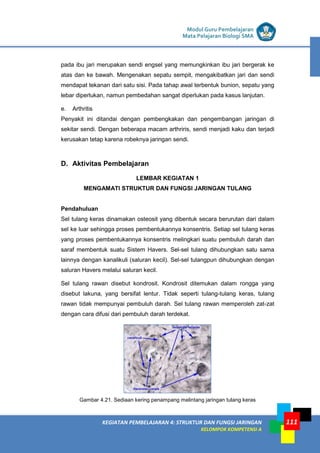 LISTRIK untuk SMP
KEGIATAN PEMBELAJARAN 4: STRUKTUR DAN FUNGSI JARINGAN
KELOMPOK KOMPETENSI A
Modul Guru Pembelajaran
Mata Pelajaran Biologi SMA
111
pada ibu jari merupakan sendi engsel yang memungkinkan ibu jari bergerak ke
atas dan ke bawah. Mengenakan sepatu sempit, mengakibatkan jari dan sendi
mendapat tekanan dari satu sisi. Pada tahap awal terbentuk bunion, sepatu yang
lebar diperlukan, namun pembedahan sangat diperlukan pada kasus lanjutan.
e. Arthritis
Penyakit ini ditandai dengan pembengkakan dan pengembangan jaringan di
sekitar sendi. Dengan beberapa macam arthriris, sendi menjadi kaku dan terjadi
kerusakan tetap karena robeknya jaringan sendi.
D. Aktivitas Pembelajaran
LEMBAR KEGIATAN 1
MENGAMATI STRUKTUR DAN FUNGSI JARINGAN TULANG
Pendahuluan
Sel tulang keras dinamakan osteosit yang dibentuk secara berurutan dari dalam
sel ke luar sehingga proses pembentukannya konsentris. Setiap sel tulang keras
yang proses pembentukannya konsentris melingkari suatu pembuluh darah dan
saraf membentuk suatu Sistem Havers. Sel-sel tulang dihubungkan satu sama
lainnya dengan kanalikuli (saluran kecil). Sel-sel tulangpun dihubungkan dengan
saluran Havers melalui saluran kecil.
Sel tulang rawan disebut kondrosit. Kondrosit ditemukan dalam rongga yang
disebut lakuna, yang bersifat lentur. Tidak seperti tulang-tulang keras, tulang
rawan tidak mempunyai pembuluh darah. Sel tulang rawan memperoleh zat-zat
dengan cara difusi dari pembuluh darah terdekat.
Gambar 4.21. Sediaan kering penampang melintang jaringan tulang keras
 