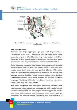 PPPPTK IPA
Direktorat Jenderal Guru dan Tenaga Kependidikan - Kemdikbud
KEGIATAN PEMBELAJARAN 1: SISTEM EKSRESI MANUSIA
KELOMPOK KOMPETENSI D
20
Gambar 1.9. Ilustrasi seseorang yang sedang menjalani proses dialisis buatan
(hemodialisis)
Pencangkokan ginjal
Salah satu alternatif penanggulangan gagal ginjal adalah dengan melakukan
pencangkokan organ ginjal. Transplantasi (cangkok) ginjal adalah proses
pencangkokan ginjal ke dalam tubuh seseorang melalui tindakan pembedahan.
Ginjal baru bersama ginjal lama yang fungsinya sudah memburuk akan bekerja
bersama-sama untuk mengeluarkan sampah metabolisme dari dalam tubuh.
Dokter bedah akan meletakkan ginjal di dalam perut sebelah bawah, kemudian
menghubungkan pembuluh darah dan saluran kencing (ureter) ginjal baru
tersebut ke pembuluh darah dan ureter penderita (Gambar 1.10). Setelah
terhubung, ginjal akan dialiri darah yang akan dibersihkan. Air kencing (urine)
biasanya langsung diproduksi. Tetapi beberapa keadaan, urine diproduksi
bahkan setelah beberapa minggu. Ginjal lama yang dua buah akan dibiarkan di
tempatnya. Tetapi jika ginjal tersebut menyebabkan infeksi atau menimbulkan
penyakit darah tinggi, maka harus diangkat.
Tidak semua orang cocok untuk mendapatkan transplantasi. Beberapa kondisi
dapat membuat proses transplantasi berbahaya atau tidak mungkin berhasil.
Ginjal baru dapat diperoleh dari donor yang baru saja meninggal dunia, atau dari
donor hidup. Donor hidup bisa keluarga, bisa juga bukan, biasanya pasangan
atau teman. Jika anda tidak memiliki donor hidup, anda akan dimasukkan ke
 