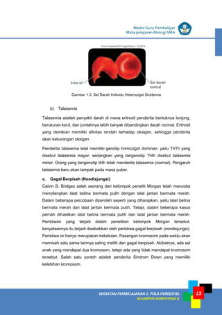 KEGIATAN PEMBELAJARAN 1: POLA HEREDITAS
KELOMPOK KOMPETENSI G
Modul Guru Pembelajar
Mata pelajaran Biologi SMA
13
Gambar 1.3. Sel Darah Individu Heterozigot Sicklemia
b) Talasemia
Talasemia adalah penyakit darah di mana eritrosit penderita bentuknya lonjong,
berukuran kecil, dan jumlahnya lebih banyak dibandingkan darah normal. Eritrosit
yang demikian memiliki afinitas rendah terhadap oksigen, sehingga penderita
akan kekurangan oksigen.
Penderita talasemia letal memiliki genotip homozigot dominan, yaitu ThTh yang
disebut talasemia mayor, sedangkan yang bergenotip Thth disebut talasemia
minor. Orang yang bergenotip thth tidak menderita talasemia (normal). Pengaruh
talasemia baru akan tampak pada masa puber.
c. Gagal Berpisah (Nondisjungsi)
Calvin B. Bridges salah seorang dari kelompok peneliti Morgan telah mencoba
menyilangkan lalat betina bermata putih dengan lalat jantan bermata merah.
Dalam beberapa percobaan diperoleh seperti yang diharapkan, yaitu lalat betina
bermata merah dan lalat jantan bermata putih. Tetapi, dalam beberapa kasus
pernah dihasilkan lalat betina bermata putih dan lalat jantan bermata merah.
Peristiwan yang terjadi dalam penelitian kelompok Morgan tersebut,
kenyataannya itu terjadi disebabkan oleh peristiwa gagal berpisah (nondisjungsi).
Peristiwa ini hanya merupakan kebetulan. Pasangan kromosom pada waktu akan
memisah satu sama lainnya saling melilit dan gagal berpisah. Akibatnya, ada sel
anak yang mendapat dua kromosom, tetapi ada yang tidak mendapat kromosom
tersebut. Salah satu contoh adalah penderita Sindrom Down yang memiliki
kelebihan kromosom.
 