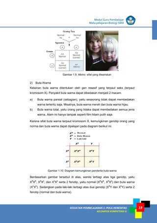 KEGIATAN PEMBELAJARAN 1: POLA HEREDITAS
KELOMPOK KOMPETENSI G
Modul Guru Pembelajar
Mata pelajaran Biologi SMA
19
Gambar 1.9. Albino: sifat yang diwariskan
2) Buta Warna
Kelainan buta warna ditentukan oleh gen resesif yang terpaut seks (terpaut
kromosom X). Penyakit buta warna dapat dibedakan menjadi 2 macam.
a) Buta warna parsial (sebagian), yaitu seseorang tidak dapat membedakan
warna tertentu saja. Misalnya, buta warna merah dan buta warna hijau.
b) Buta warna total, yaitu orang yang tidaka dapat membedakan semua jenis
warna. Alam ini hanya tampak seperti film hitam putih saja.
Karena sifat buta warna terpaut kromosom X, kemungkinan genotip orang yang
norma dan buta warna dapat dipelajari pada diagram berikut ini.
Gambar 1.10. Diagram kemungkinan penderita buta warna
Berdasarkan gambar tersebut di atas, wanita terbagi atas tiga genotip, yaitu
XB
XB
, XB
Xb
, dan Xb
Xb
serta 2 fenotip, yaitu normal (XB
XB
, XB
Xb
) dan buta warna
(Xb
Xb
). Sedangkan pada laki-laki terbagi atas dua genotip (XB
Y dan Xb
Y) serta 2
fenotip (normal dan buta warna).
 