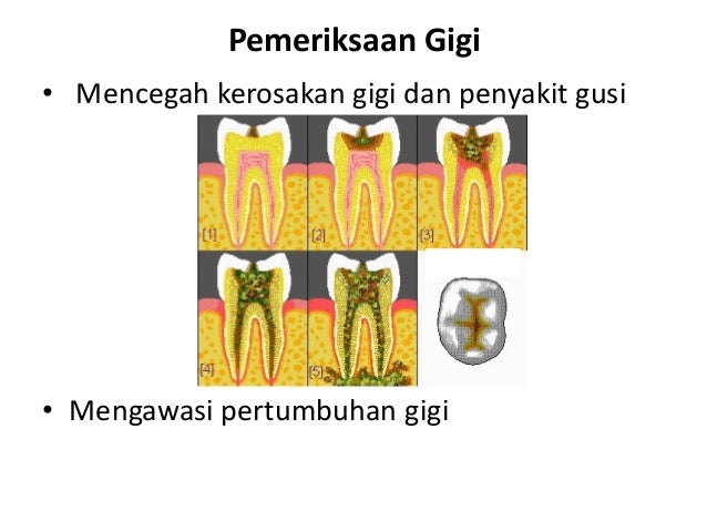 KESIHATAN PERGIGIAN & MULUT UNTUK KANAK-KANAK ISTIMEWA