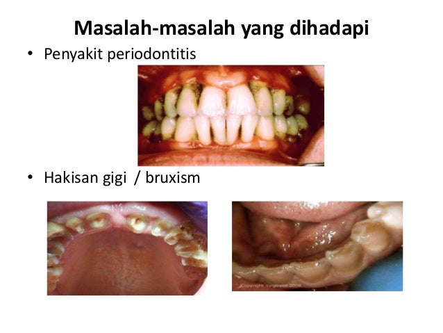KESIHATAN PERGIGIAN & MULUT UNTUK KANAK-KANAK ISTIMEWA KESIHATAN PERGIGIAN & MULUT UNTUK KANAK-KANAK ISTIMEWA