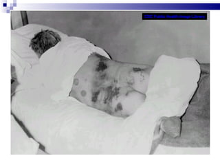 CDC Public Health Image Library 