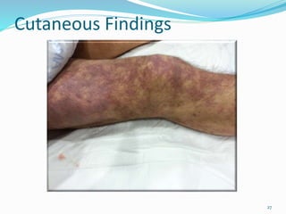 Cutaneous Findings
27
 