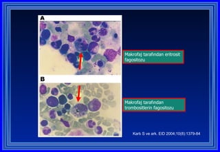 Makrofaj tarafından eritrosit fagositozu Makrofaj tarafından trombositlerin fagositozu Kartı S ve ark. EID 2004;10(8):1379-84 