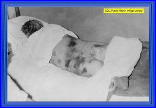 CDC Public Health Image Library 