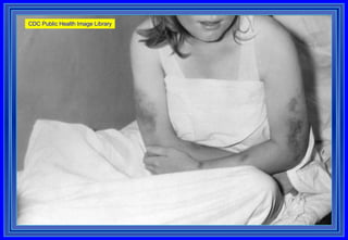 CDC Public Health Image Library 