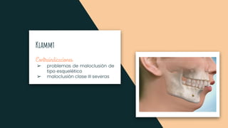 Klammt
Contraindicaciones
➢
➢
 