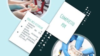 DOBLE ARCO VESTIBULAR
❖
❖
❖
Compuesto
por
 