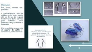 Elaboración
Los arcos labiales son
paralelos.
A nivel del primer molar se
doblan en un ansa, desde
ahí se llevan de regreso
hasta mesial de los caninos
para doblarlos hacia
palatino o lingual hacia la
retención.
El arco palatino se asemeja
al resorte de coffin y
conecta las partes acrílicas utilizado en placas removibles para
ampliar arcos estrechos, y su
aplicación clínica es con frecuencia
recomendada
 