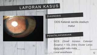 ODS Katarak senilis stadium
matur
- SICS (Small Incision Cataract
Surgery) + IOL (Intra Ocular Lens)
pada salah satu mata
- Local anesthesia 12 12
 