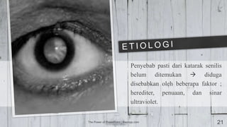 Penyebab pasti dari katarak senilis
belum ditemukan  diduga
disebabkan oleh beberapa faktor ;
herediter, penuaan, dan sinar
ultraviolet.
The Power of PowerPoint | thepopp.com 21
 
