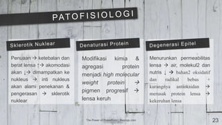 The Power of PowerPoint | thepopp.com 23
Penuaan  ketebalan dan
berat lensa ↑ akomodasi
akan ↓ dimampatkan ke
nukleus  inti nukleus
akan alami penekanan &
pengerasan  sklerotik
nuklear
Modifikasi kimia &
agregasi protein
menjadi high molecular
weight protein 
pigmen progresif 
lensa keruh
Menurunkan permeabilitas
lensa  air, molekul2 dan
nutris ↓  bahan2 oksidatif
dan radikal bebas +
kurangnya antioksidan 
merusak protein lensa 
kekeruhan lensa
 
