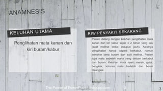 The Power of PowerPoint | thepopp.com 3
Penglihatan mata kanan dan
kiri buram/kabur
Pasien datang dengan keluhan penglihatan mata
kanan dan kiri kabur sejak ± 2 tahun yang lalu
(saat melihat dekat ataupun jauh). Awalnya
penglihatan hanya seperti berkabut, namun
semakin lama buram dan sulit melihat. Pasien
lupa mata sebelah mana yang deluan berkabut
dan buram. Keluhan mata nyeri, merah, gatal,
bengkak, kotoran mata berlebih dan berair
disangkal.
3
 