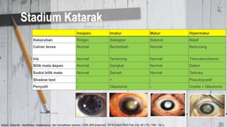 Stadium Katarak
Insipien Imatur Matur Hipermatur
Kekeruhan Ringan Sebagian Seluruh Masif
Cairan lensa Normal Bertambah Normal Berkurang
Iris Normal Terdorong Normal Tremulans/tremor
Bilik mata depan Normal Dangkal Normal Dalam
Sudut bilik mata Normal Sempit Normal Terbuka
Shadow test - + - Pseudopositif
Penyulit - Glaukoma - Uveitis + Glaukoma
30
Astari. Katarak : klasifikasi, tatalaksana, dan komplikasi operasi. CDK-269 [internet]. 2018 [cited 2023 Feb 03]; 45 (10): 748 – 52 p
 