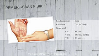 Keadaan umum : Baik
Kesadaran : CM E4V5M6
Tanda vital :
• N : 83 x/m
• TD : 180/100 mmHg
• R : 18 x/m
The Power of PowerPoint | thepopp.com 6 6
 