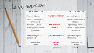 OCULUS DEXTER OCULUS SINISTER
Hiperemis (-) ptosis (-)
edema (-) eksotropion (-)
entropion (-)
PALPEBRA INFERIOR Hiperemis (-) ptosis (-)
edema (-) eksotropion (-)
entropion (-)
Hiperemis (-), sekret (-)
sikatrik (-) papil (-) folikel
(-) massa(-)
KONJUNGTIVA
TARSALIS
Hiperemis (-), sekret (-)
sikatrik (-) papil (-) folikel
(-) massa (-)
Injeksi konjungtiva (-)
pterigium (-)
KONJUNGTIVA BULBI Injeksi konjungtiva (-)
Pterigium (-)
Arcus sinilis (+) KORNEA Arcus sinilis (+)
Dalam COA Dalam
8
 