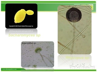 www.themegallery.com
Rhyzopus sp
Sacharomyces sp
 
