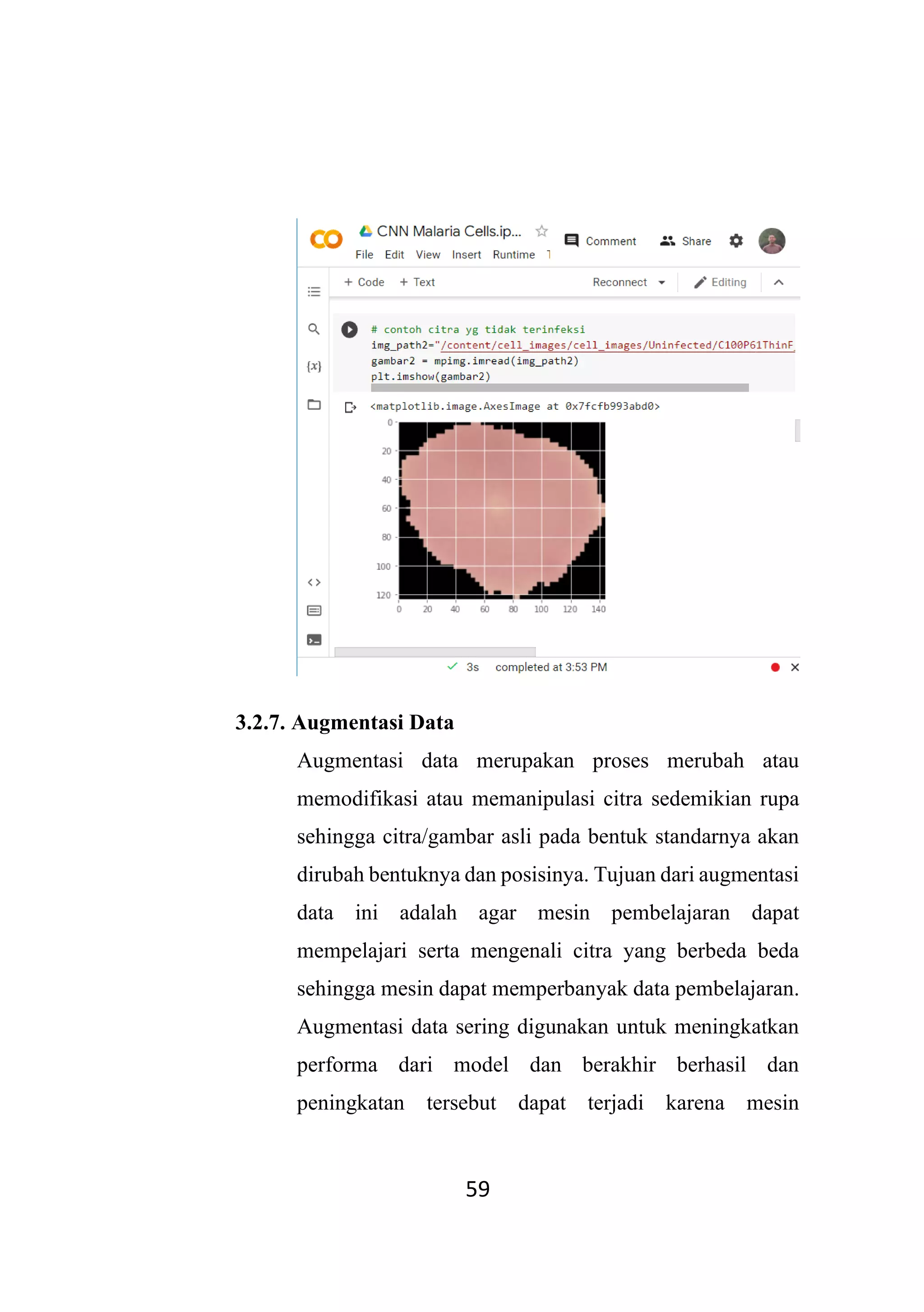 Convolutional Neural Network Malaria Cells oleh Moh. Taufiq Novianto | PDF