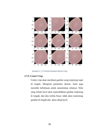 Convolutional Neural Network Malaria Cells oleh Moh. Taufiq Novianto | PDF