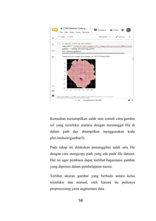 Convolutional Neural Network Malaria Cells oleh Moh. Taufiq Novianto | PDF