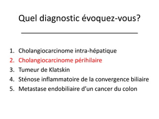 Quel diagnostic évoquez-vous? 
1.Cholangiocarcinomeintra-hépatique 
2.Cholangiocarcinome périhilaire 
3.Tumeur de Klatskin 
4.Sténose inflammatoire de la convergence biliaire 
5.Metastase endobiliaire d’un cancer du colon  