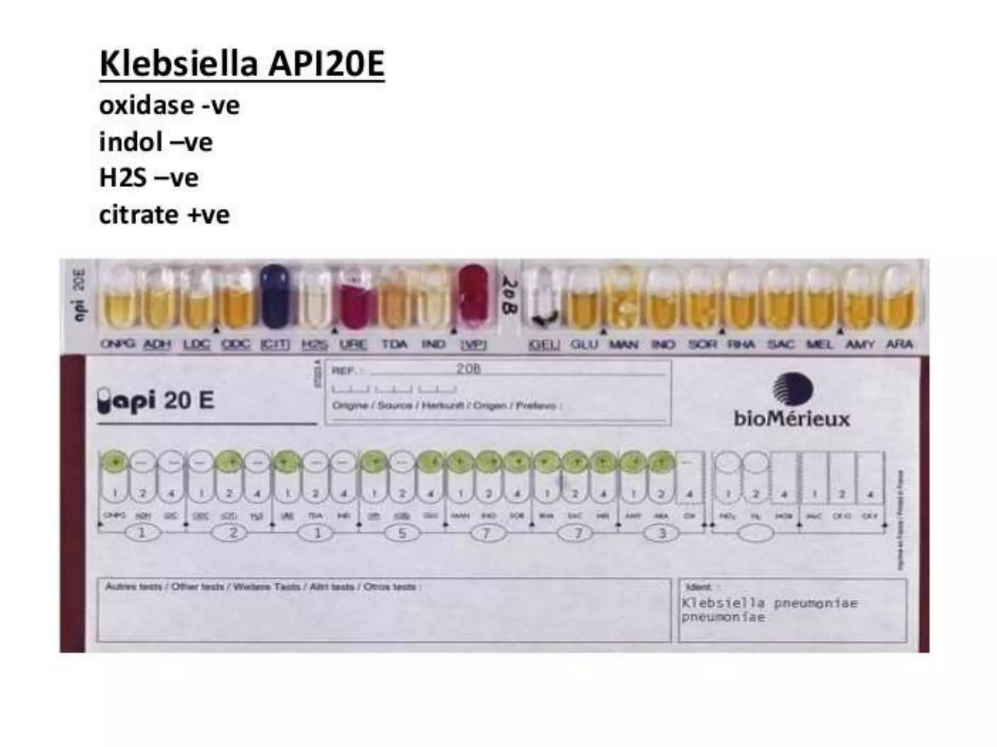 KLEBSIELLA PDF KLEBSIELLA PDF