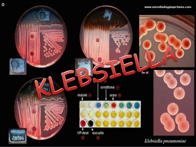 klebsiella slideshare presentation