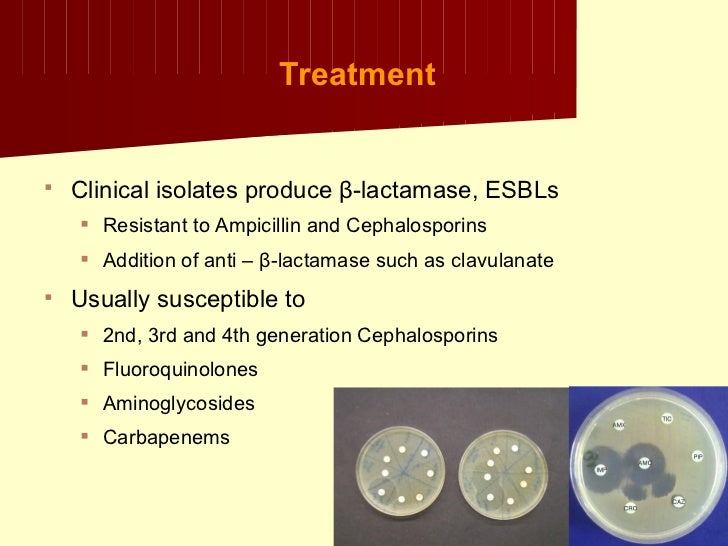 Klebsiella+proteus+uti
