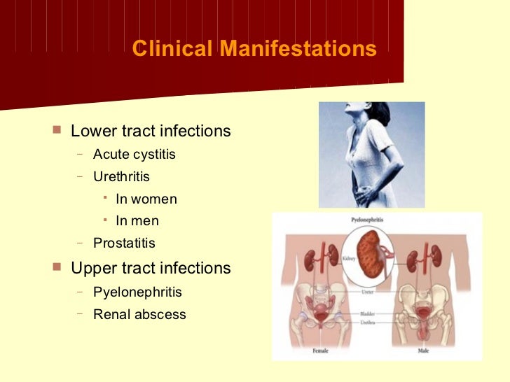 Klebsiella+proteus+uti