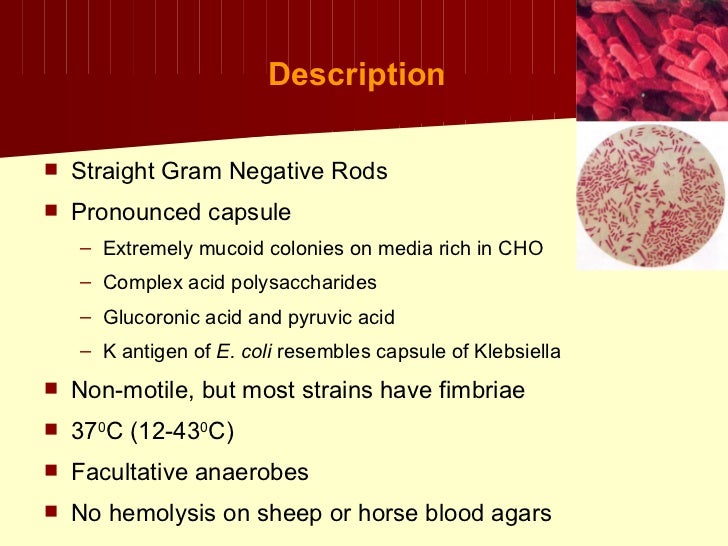 Klebsiella+proteus+uti