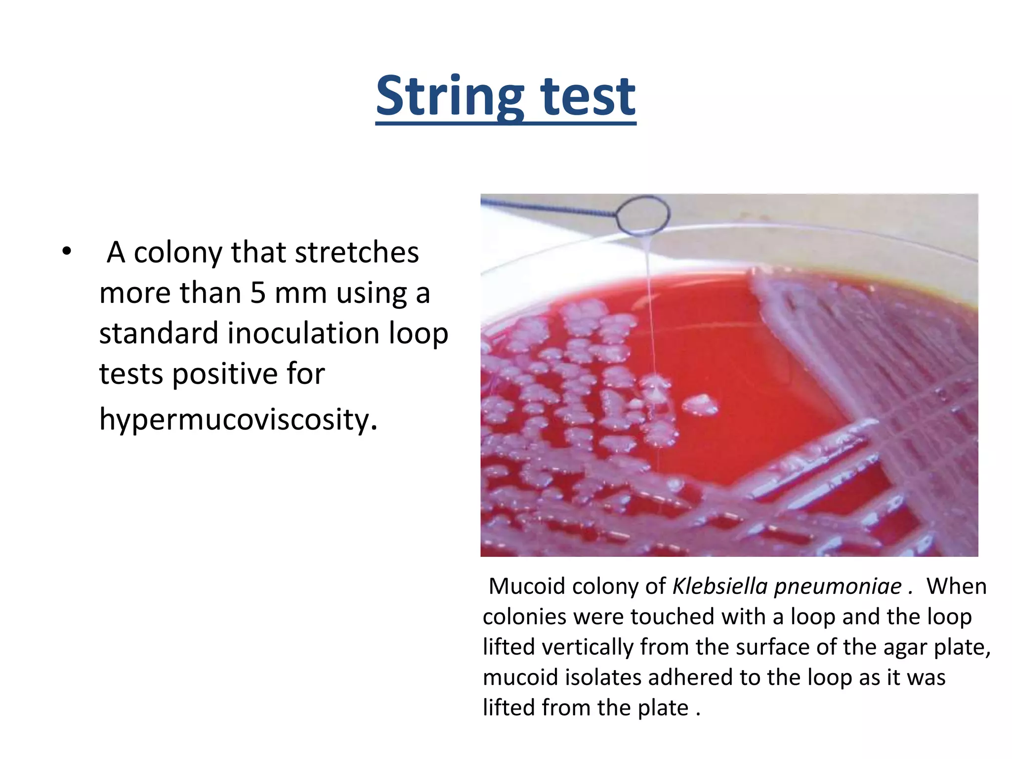 Klebsiella Spp PPTX Klebsiella Spp PPTX